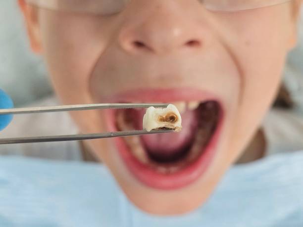 Best Emergency Dental Surgery in Tiltonsville, OH