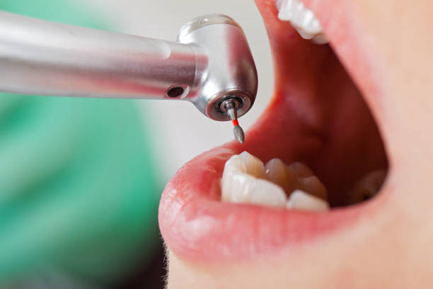 Best Emergency Treatment for Toothache in Tiltonsville, OH